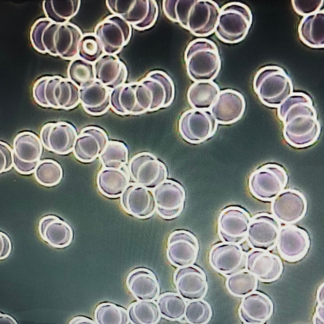 Live blood cell analysis: what it is and how it helps improve our sleep