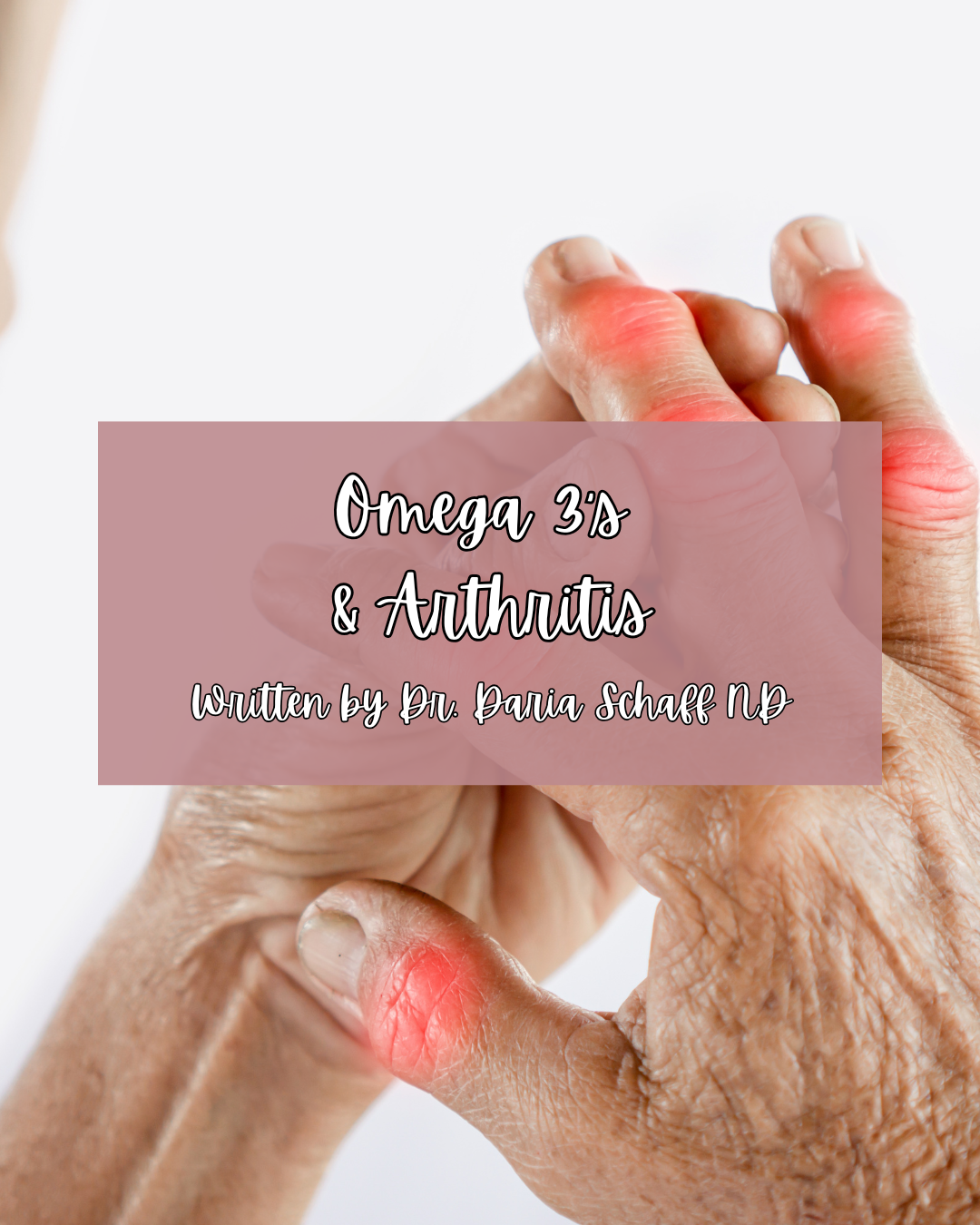 Omega 3’s and Arthritis
